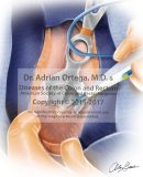 Colon-Rectum_Surgical_Images-8